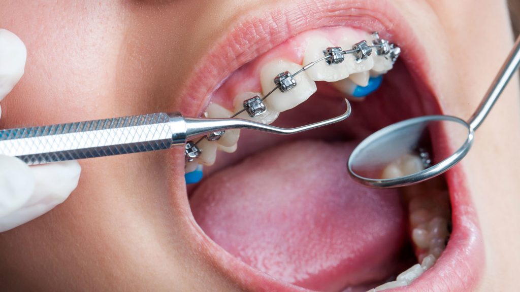 Orthodontic-treatment-1024x576